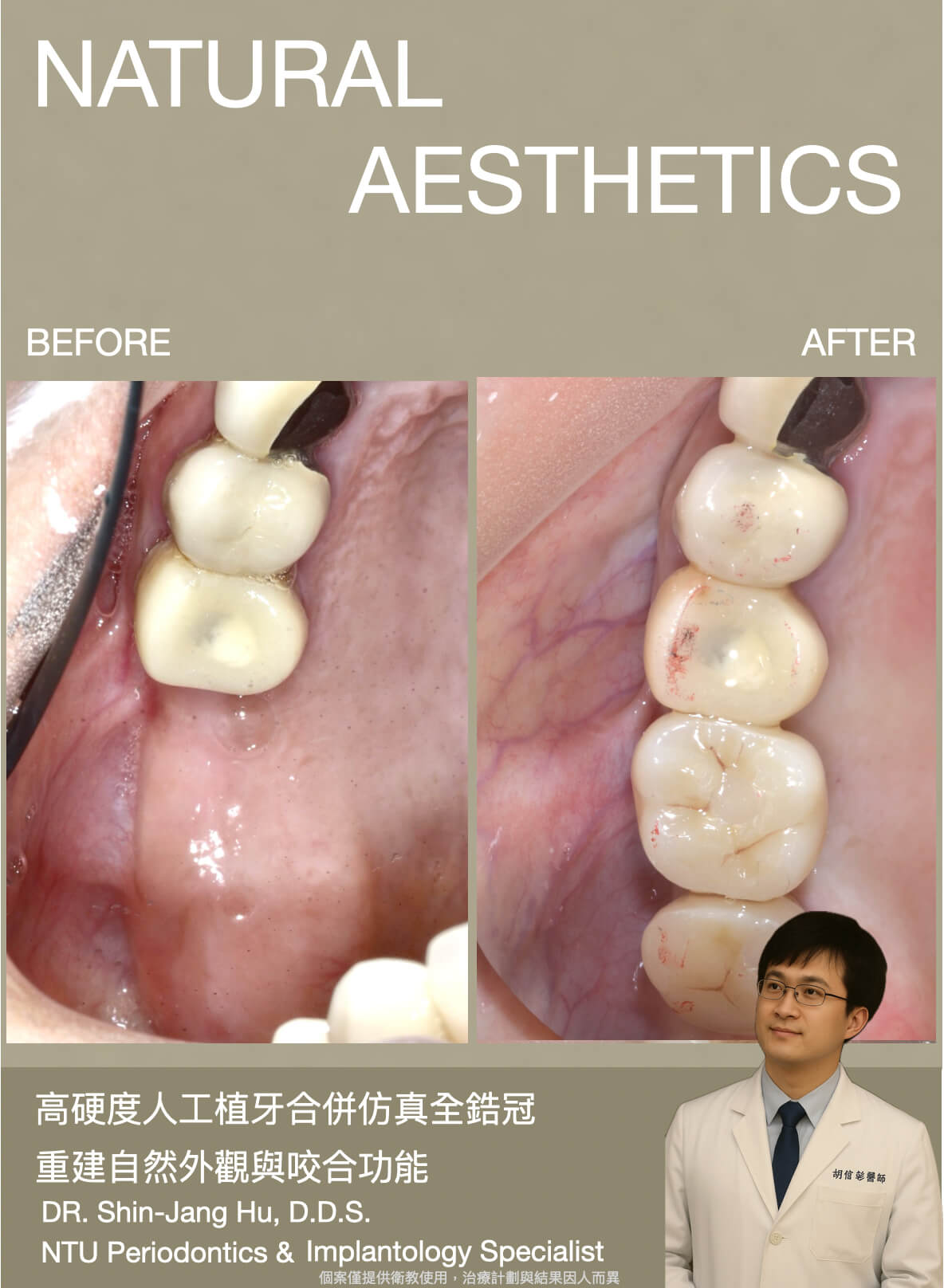 胡院長_臨床案例記錄01