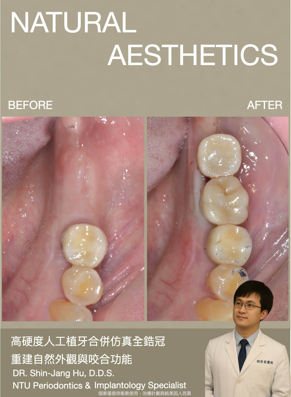 胡院長_臨床案例記錄02