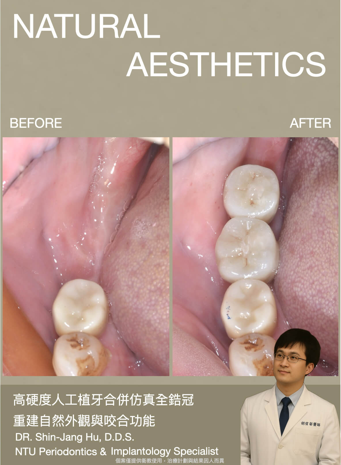 胡院長_臨床案例記錄03